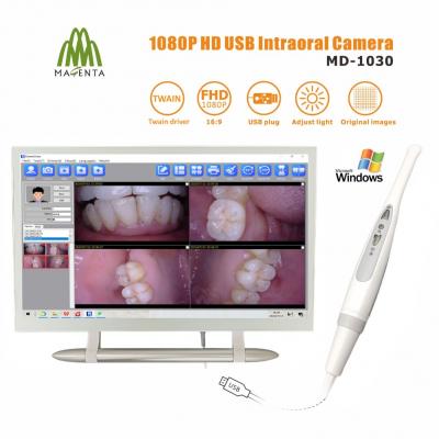MD-1030 1080P 高清USB 口腔内窥镜